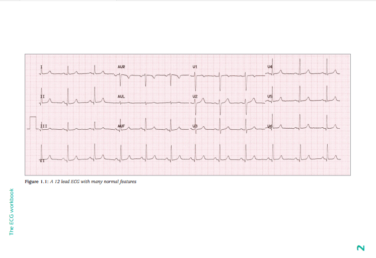 The ECG Workbook