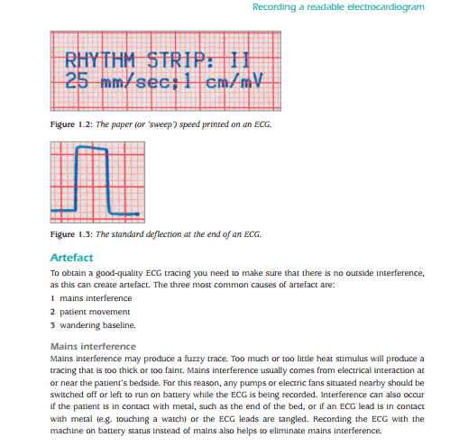 The ECG Workbook