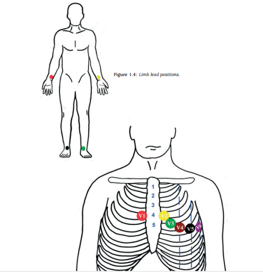 The ECG Workbook