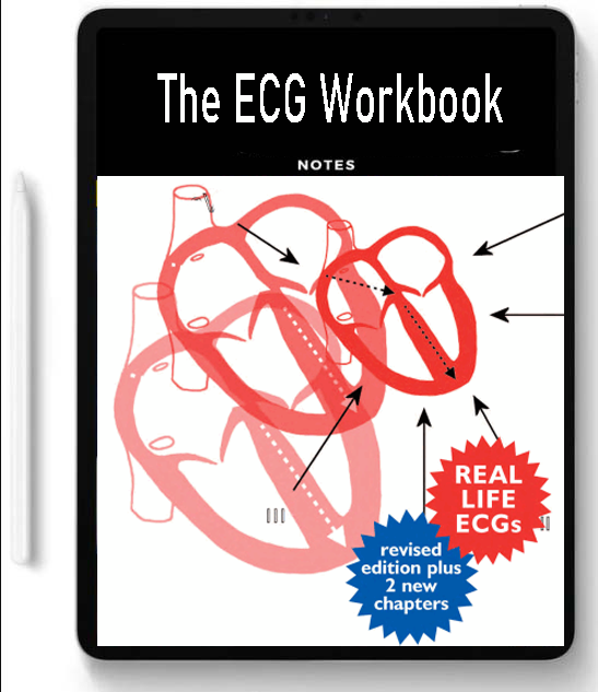 The ECG Workbook